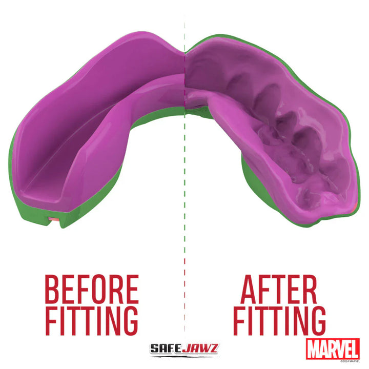 Protège-dents Safejawz Marvel Hulk